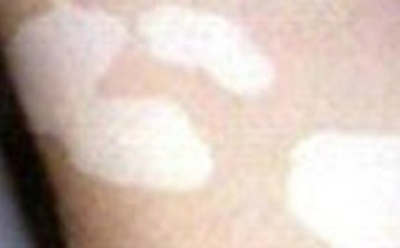 ʳ 